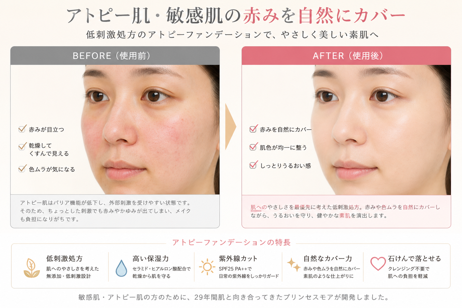 アトピー化粧下地